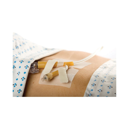 M.C. Johnson 5445-4 Cath-Secure Dual Tab Catheter Holder