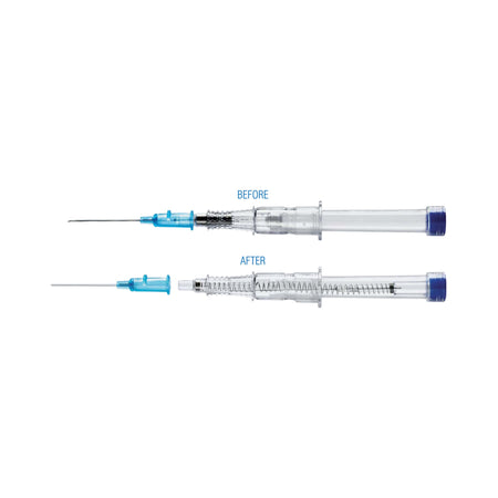 VanishPoint® Peripheral IV Catheter
