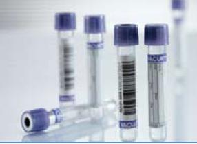 Greiner Bio-One 454217 Vacuette Venous Blood Collection Tube, 3 mL, 13 x 75 mm