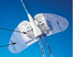 BD VPPPSP Statlock PICC Plus Central Venous Catheter Stabilization Device