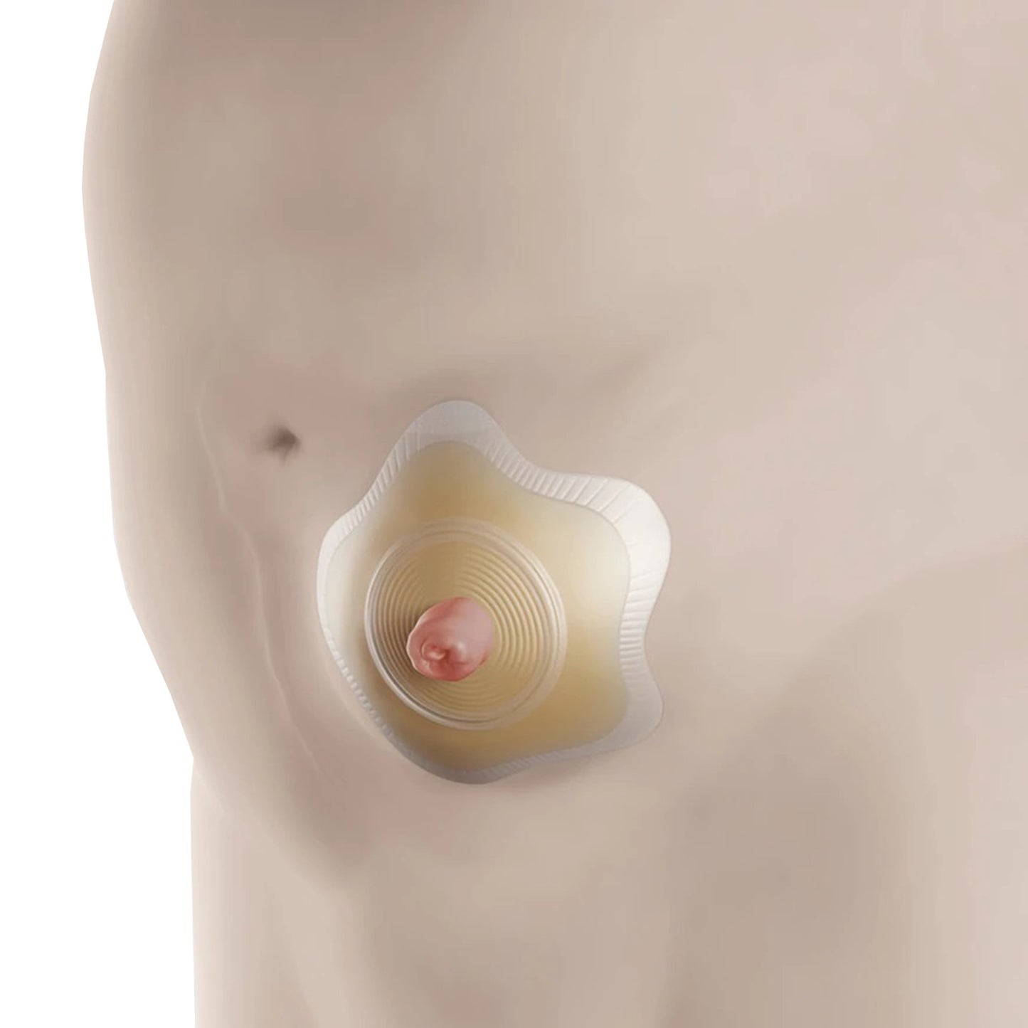 SenSura® Mio Click Convex Flip Ostomy Barrier, 35 mm Stomas, Red Match