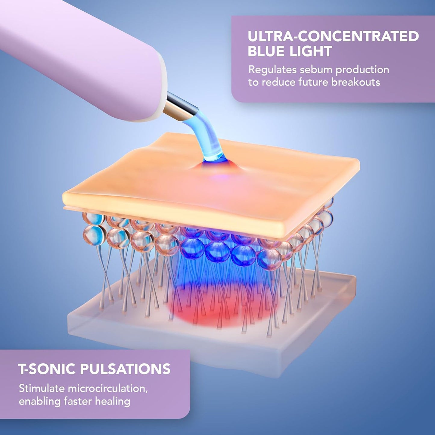 ESPADA™ 2 Plus Acne Therapy Device, Lavender