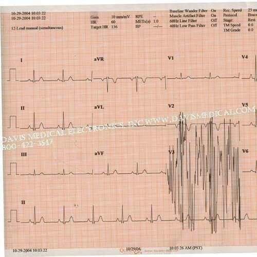 Quinton Medi-Trace Diagnostic Recording Paper, Thermal Paper, Z-Fold, Red Grid, 216mm x 200', 10/Case, 18416-002-imc