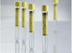 Greiner Bio-One 456007 Vacuette Urinalysis Tube, 6 mL, 13 x 100 mm