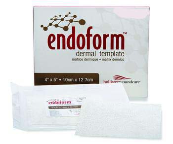 Aroa Biosurgery Inc 529311 Endoform Natural Dermal Template Nonfenestrated Collagen