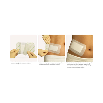 Mepore® Adhesive Dressing, 3-2/3 x 10 Inch