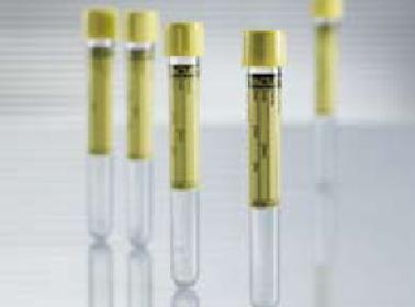 Greiner Bio-One 455028 Vacuette Urinalysis Tube, 9 mL, 16 x 100 mm