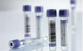 Greiner Bio-One 416962 Vacuette Venous Blood Collection Tube, 4 mL, 13 x 75 mm