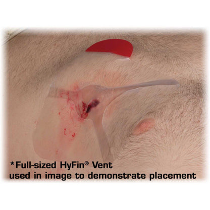 Chest Wound Seal Hyfin® Vent Compact 4-3/4 X 4-3/4 Inch 2 per Pack NonSterile