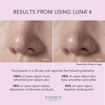 LUNA™ 4 Facial Cleansing Device for Sensitive Skin