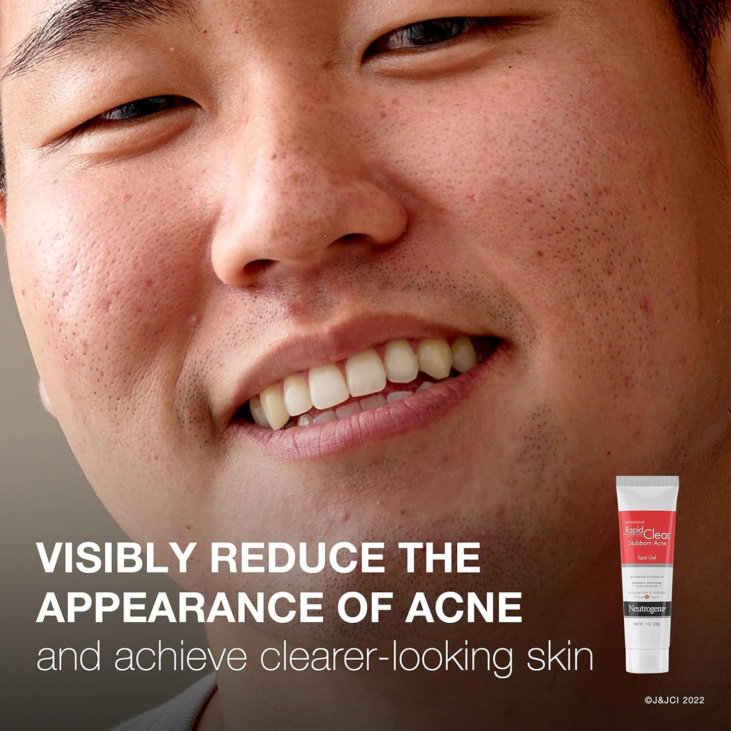Acne Treatment Neutrogena® Rapid Clear 1 oz. Gel