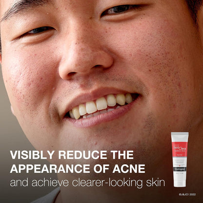Acne Treatment Neutrogena® Rapid Clear 1 oz. Gel