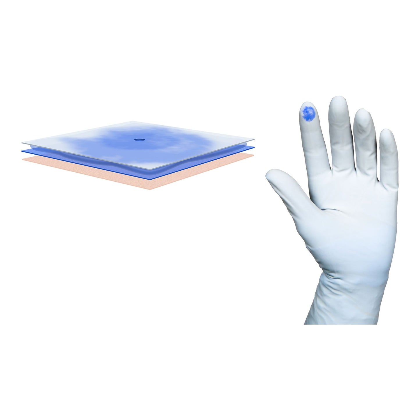 Biogel 41675 PI Indicator Polyisoprene Surgical Underglove, Size 7.5, Blue, Chemo Approved Molnlycke