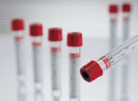 Greiner Bio-One 456089 Vacuette Z Serum Clot Activator Venous Blood Collection Tube, 6 mL, 13 x 100 mm