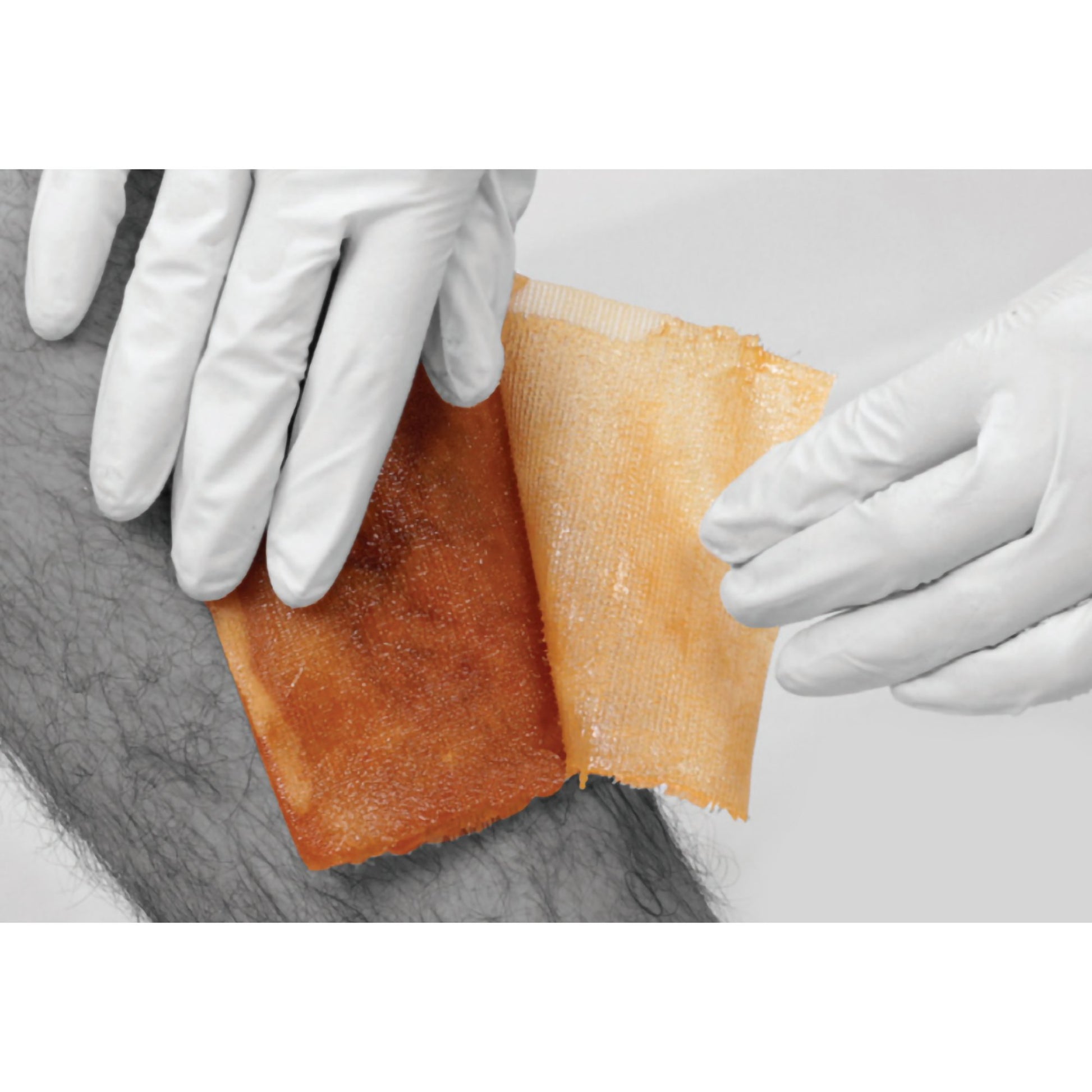 Activon medical grade manuka honey wound dressing