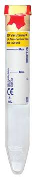 BD 364992 Vacutainer® Urinalysis Tube, 16 x 100 mm, 8 mL