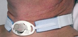 Sun Med RES242A AirLife Tracheostomy Tube Holder