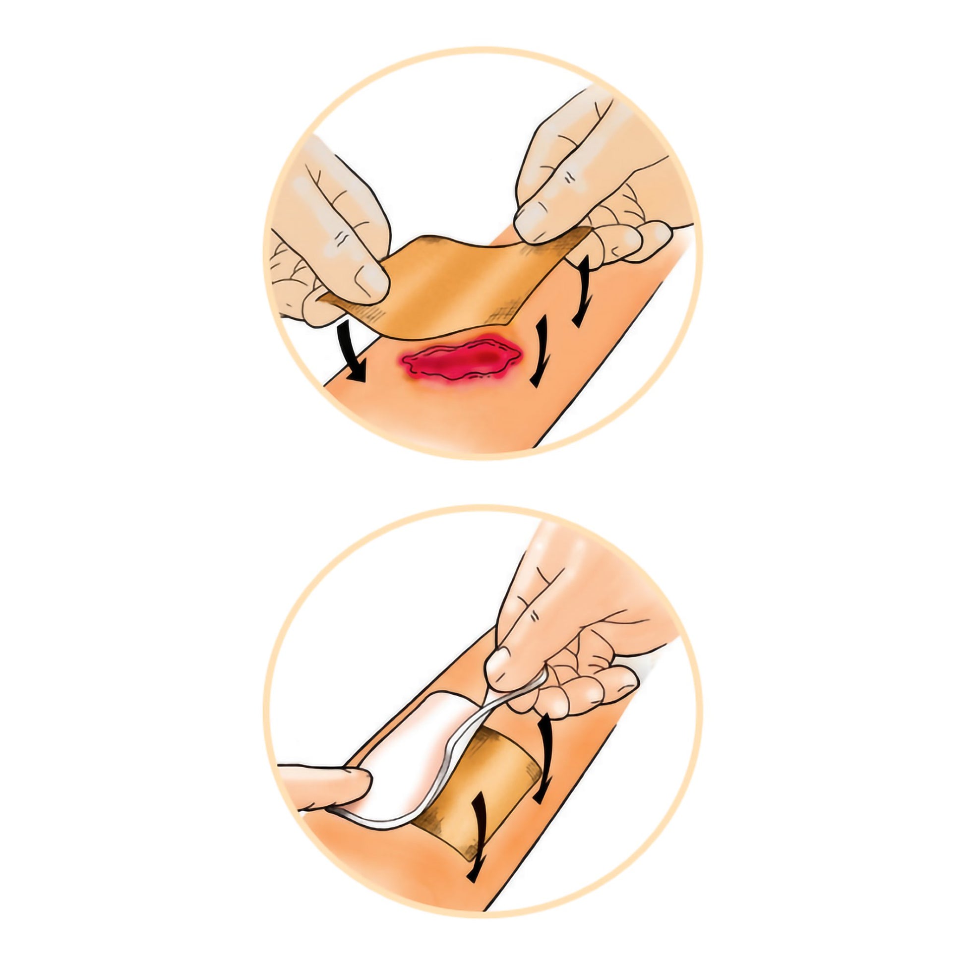 Activon medical grade manuka honey wound dressing