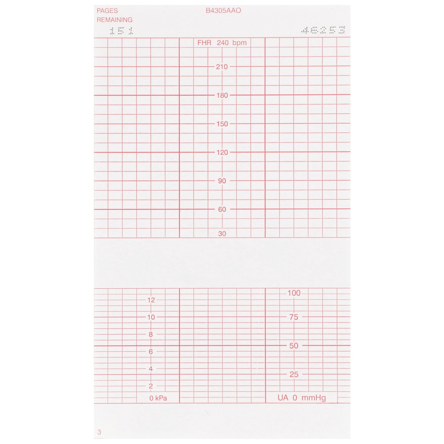 McKesson Fetal Monitoring Paper