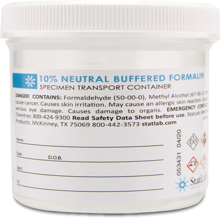 StatLab Medical Products NB0690 Prefilled Formalin Container, 90 mL Fill in 180 mL