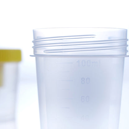 Urine Specimen Container with Integrated Transfer Device 100 mL (3.4 oz.) Screw Cap Patient Information NonSterile