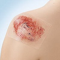 Wound Contact Layer Dressing Cuticell® Contact® 3 X 4 Inch Sterile