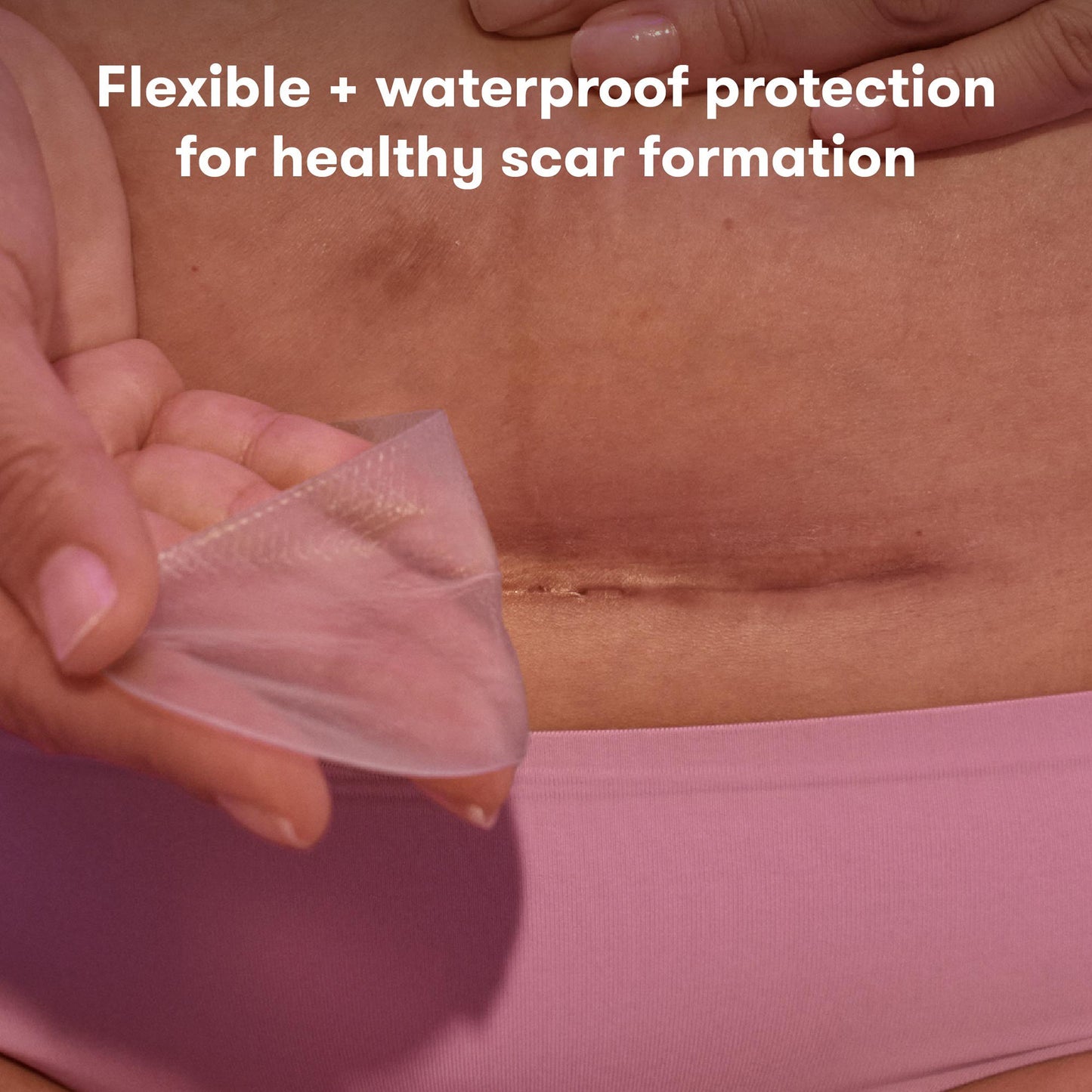 Silicone Skin Strip frida mom C-Section 8 Inch Rectangle NonSterile