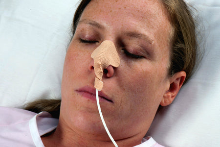 Dale Medical Products 160 Nasogastric Tube Holder for Nasogastric Feeding and Aspiration Tubes