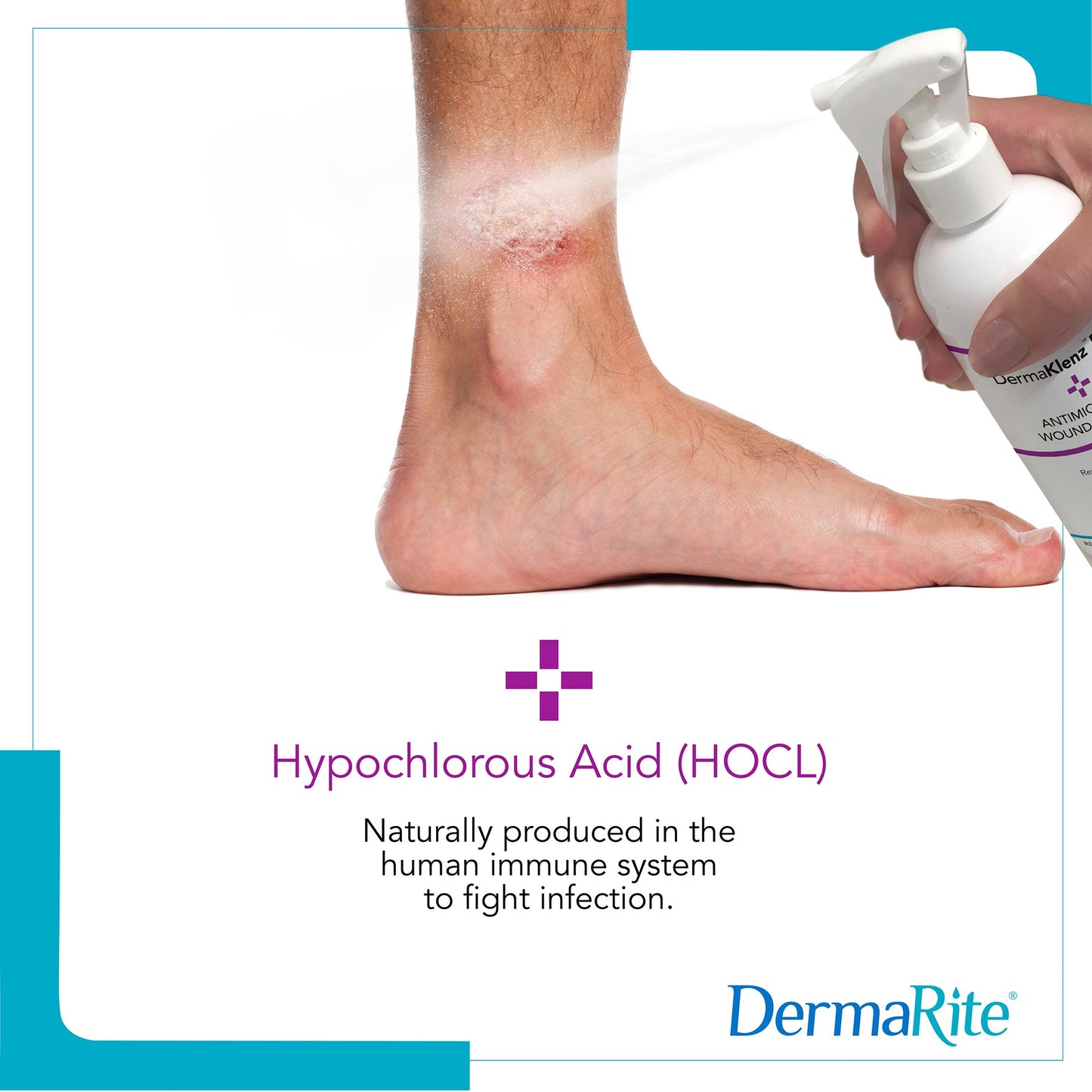DermaRite's DermaKlenz PLUS Wound Cleanser - Spray Bottle, 8 oz.