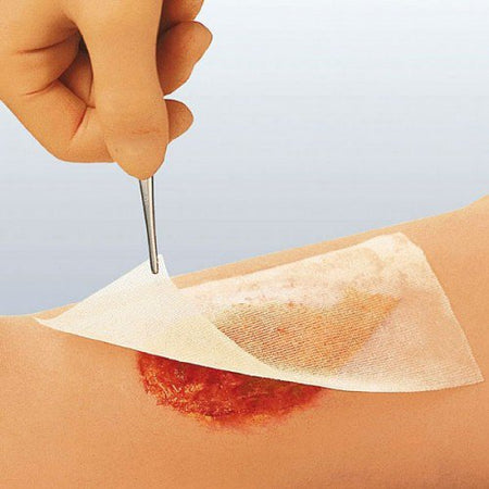 Smith & Nephew 66045564 Cuticerin Impregnated Dressing, 4 x 4 Inch