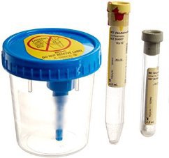 BD 364957 Vacutainer® Urine Specimen Collection Kit