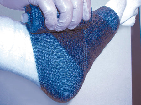 BSN 7345836 Delta-Lite Plus Light Blue Cast Tape, 3 Inch x 4 Yard