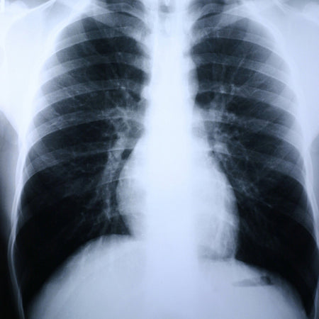 McKesson 3XA5G Clear Choice Performance X-Ray Film