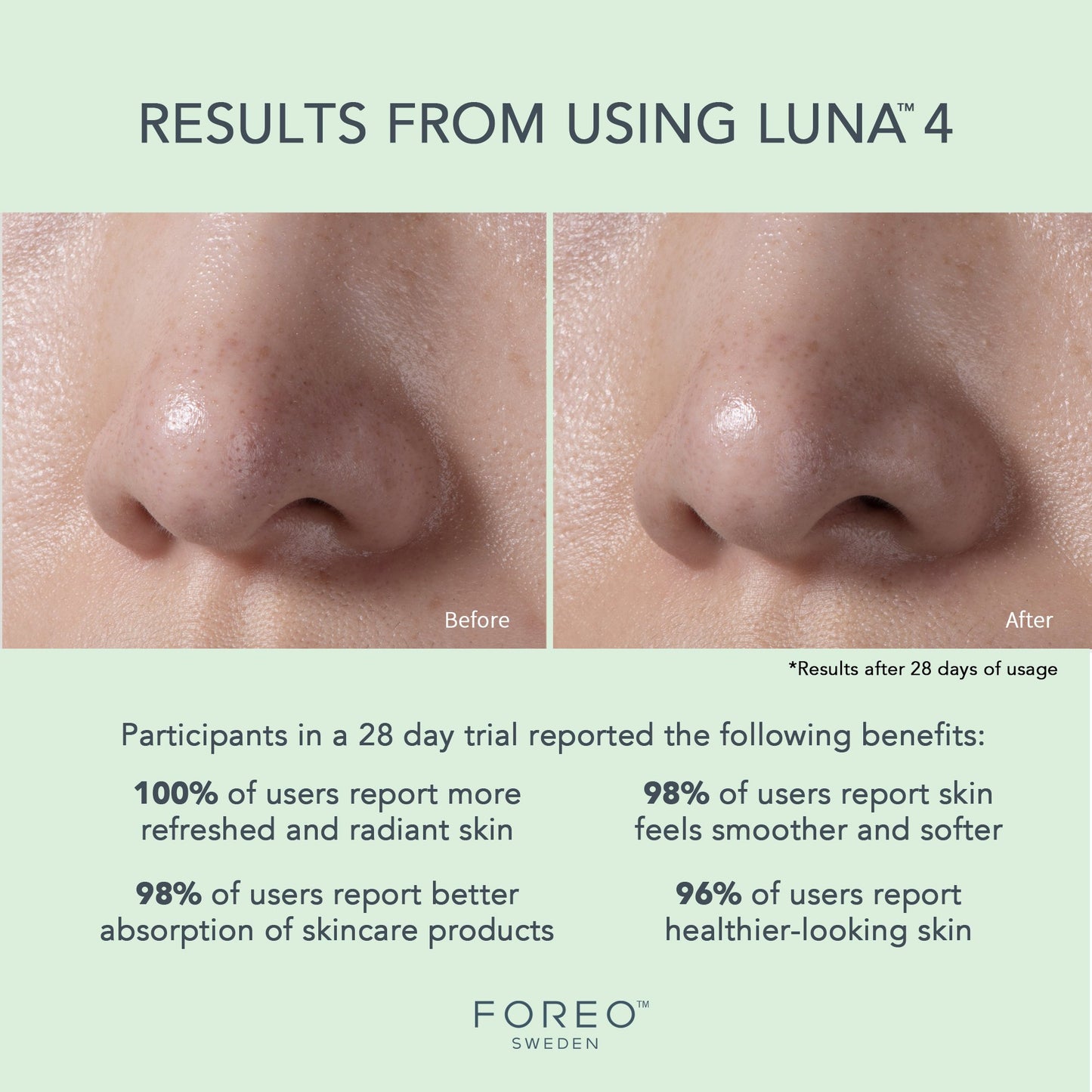 LUNA™ 4 Facial Cleansing Device for Combination Skin
