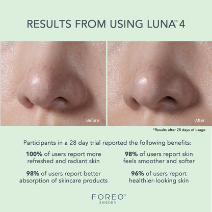LUNA™ 4 Facial Cleansing Device for Combination Skin