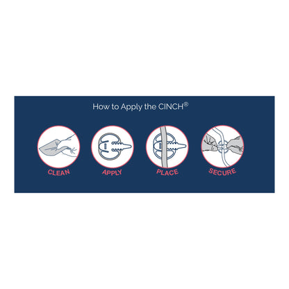 Cinch® Tube Securement Device, Large