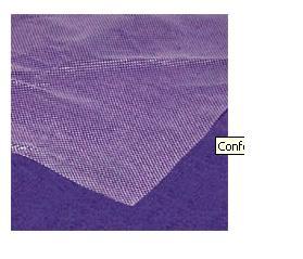 Smith & Nephew 5955044 Conformant 2 Wound Contact Layer Dressing, 4 x 4 Inch