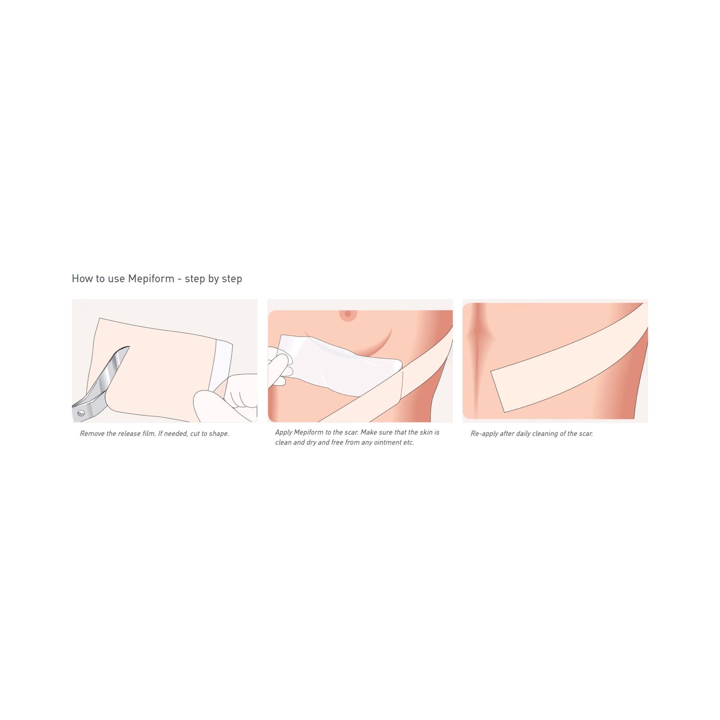 Mepiform® Self Adherent Silicone Dressing, 4 x 7 Inch