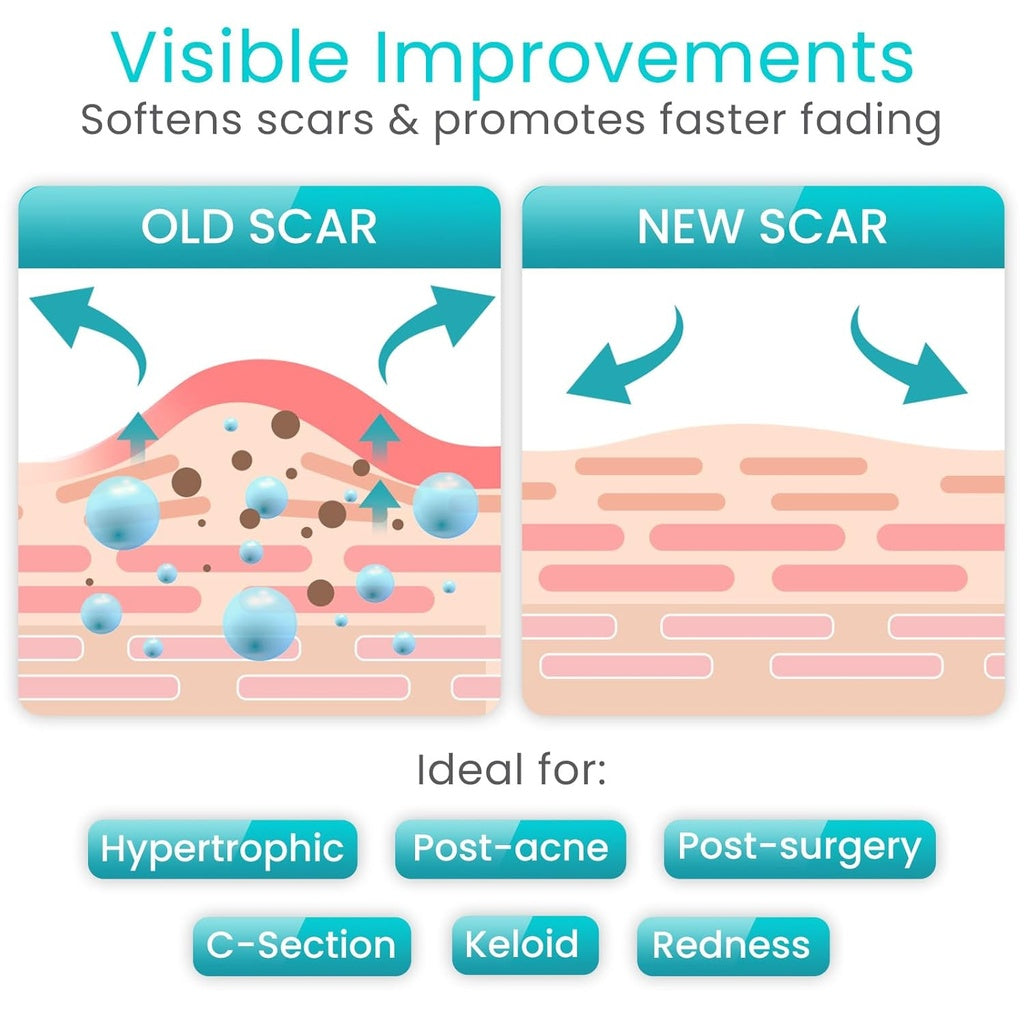 Silicone Scar Tape Vive Care by Vive product image - view 3