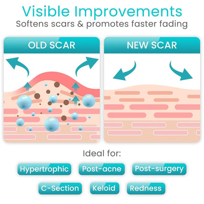 Silicone Scar Tape Vive Care by Vive product image - view 3