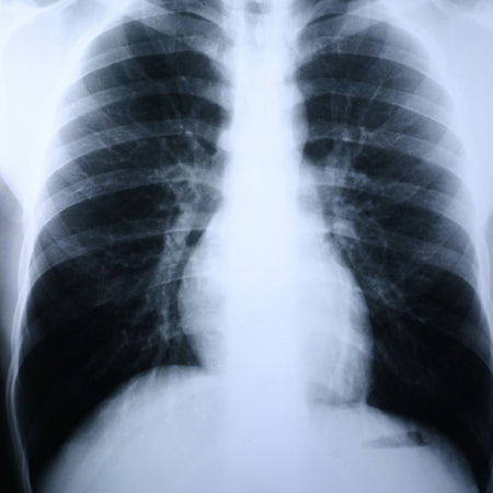 McKesson 55BN7 Clear Choice Performance X-Ray Film