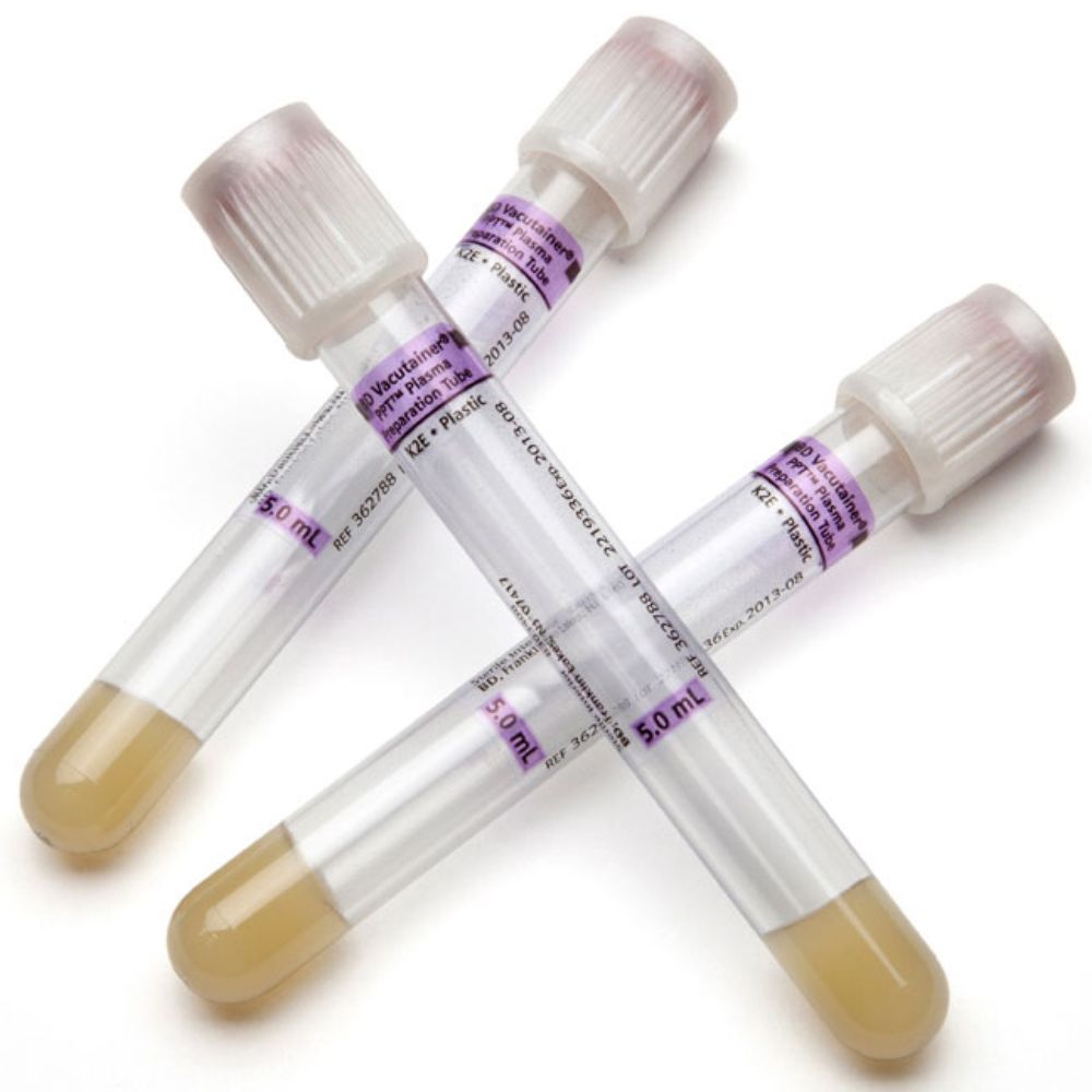 BD 362788 Vacutainer® PPT™ Molecular Diagnostic Tube, 5 mL, 13 x 100 mm