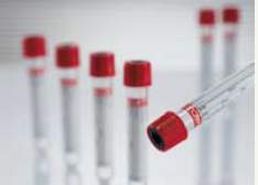 Greiner Bio-One 455092 Vacuette Z Serum Clot Activator Venous Blood Collection Tube, 9 mL, 16 x 100 mm