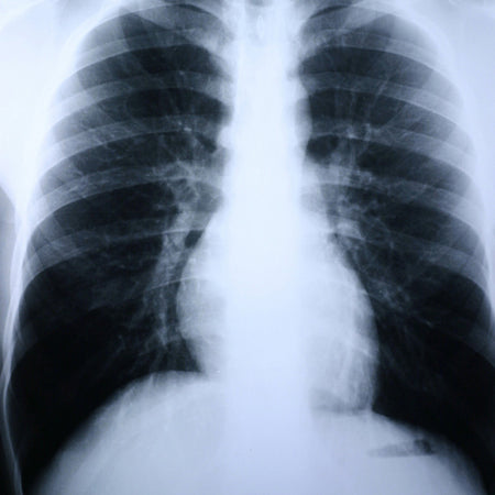 McKesson XDAMC Clear Choice Performance X-Ray Film