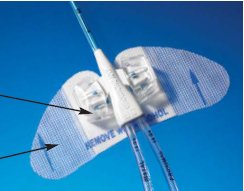 BD 472544 Statlock PICC Plus Central Venous Catheter Stabilization Device