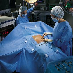 Abdominal Drape Laparoscopic / Abdominal Drape 100 W X 76 W X 124 L Inch Sterile
