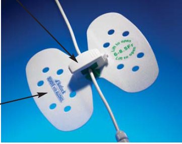 BD VUPD1416 Statlock Universal Plus Drainage Catheter Stabilization Device