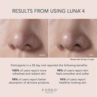 LUNA™ 4 Facial Cleansing Device for Balanced Skin