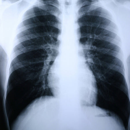 McKesson 55BUN Clear Choice Performance X-Ray Film