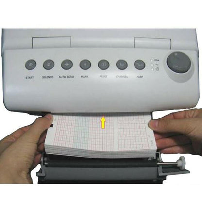 Edan® CTG Fetal Monitor Thermal Recording Paper Roll, 3.5 x 6 Inch
